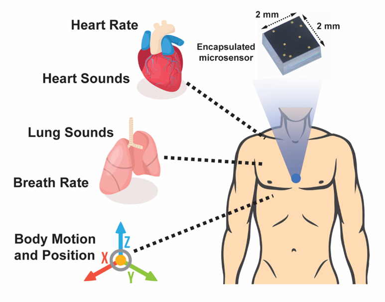 Hermetically-sealed sensor with nanogaps for cardiopulmonary health monitoring Hermetically-sealed sensor with nanogaps for cardiopulmonary health monitoring