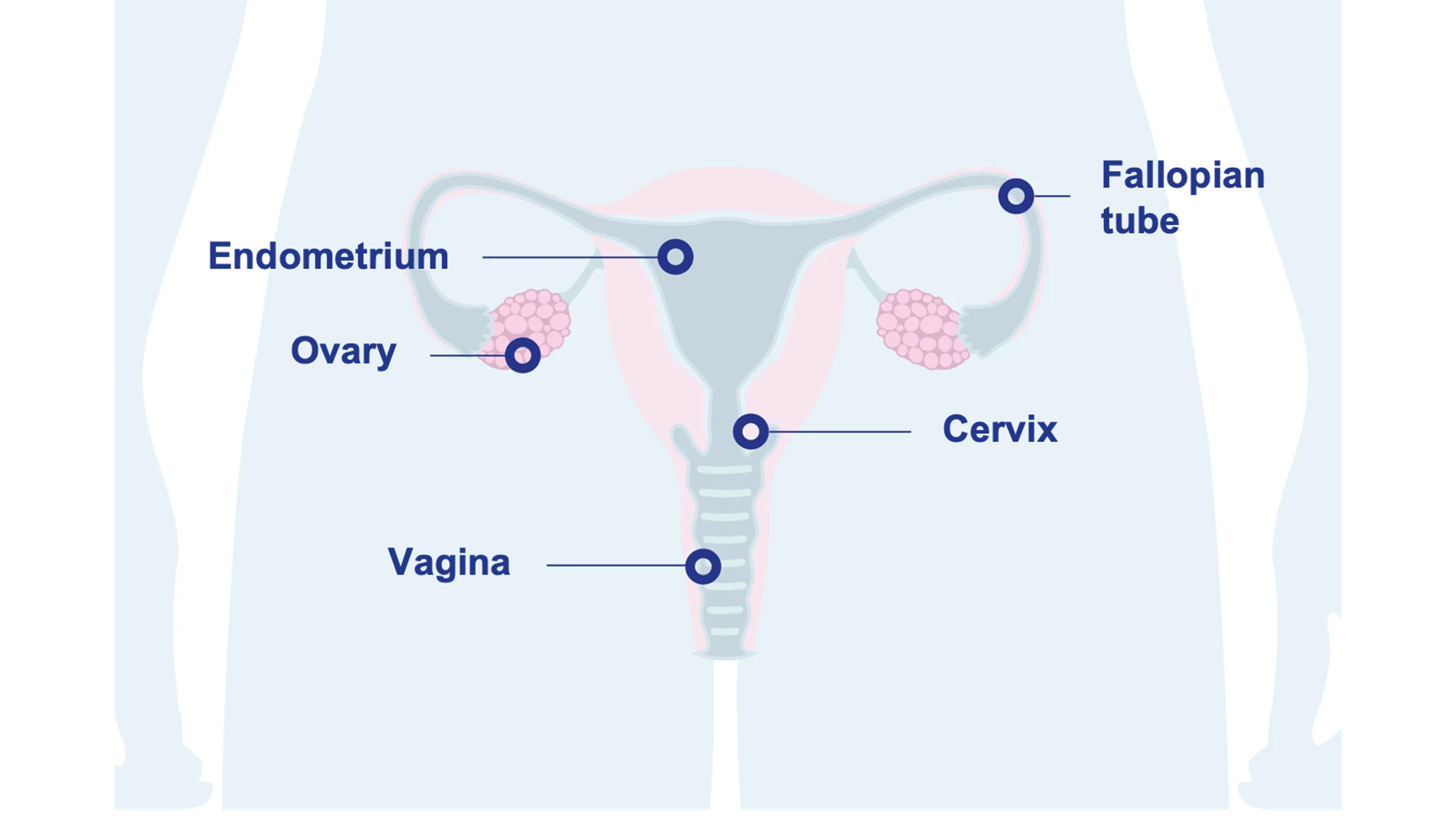 An illustration of the female reproductive system showing labeled components: ovaries, fallopian tubes, endometrium, cervix, and vagina.