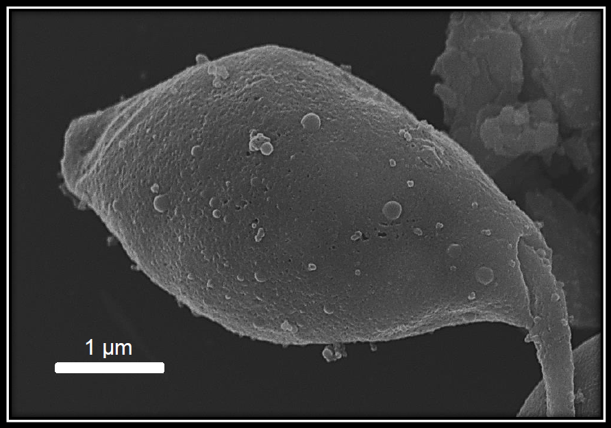 Scanning Electron Microscopy of a Leishmania spp. parasite producing vesicles. Could these vesicles also be used by viruses as a camouflage and protection envelope? Scanning Electron Microscopy of a Leishmania spp. parasite producing vesicles. Could these vesicles also be used by viruses as a camouflage and protection envelope?