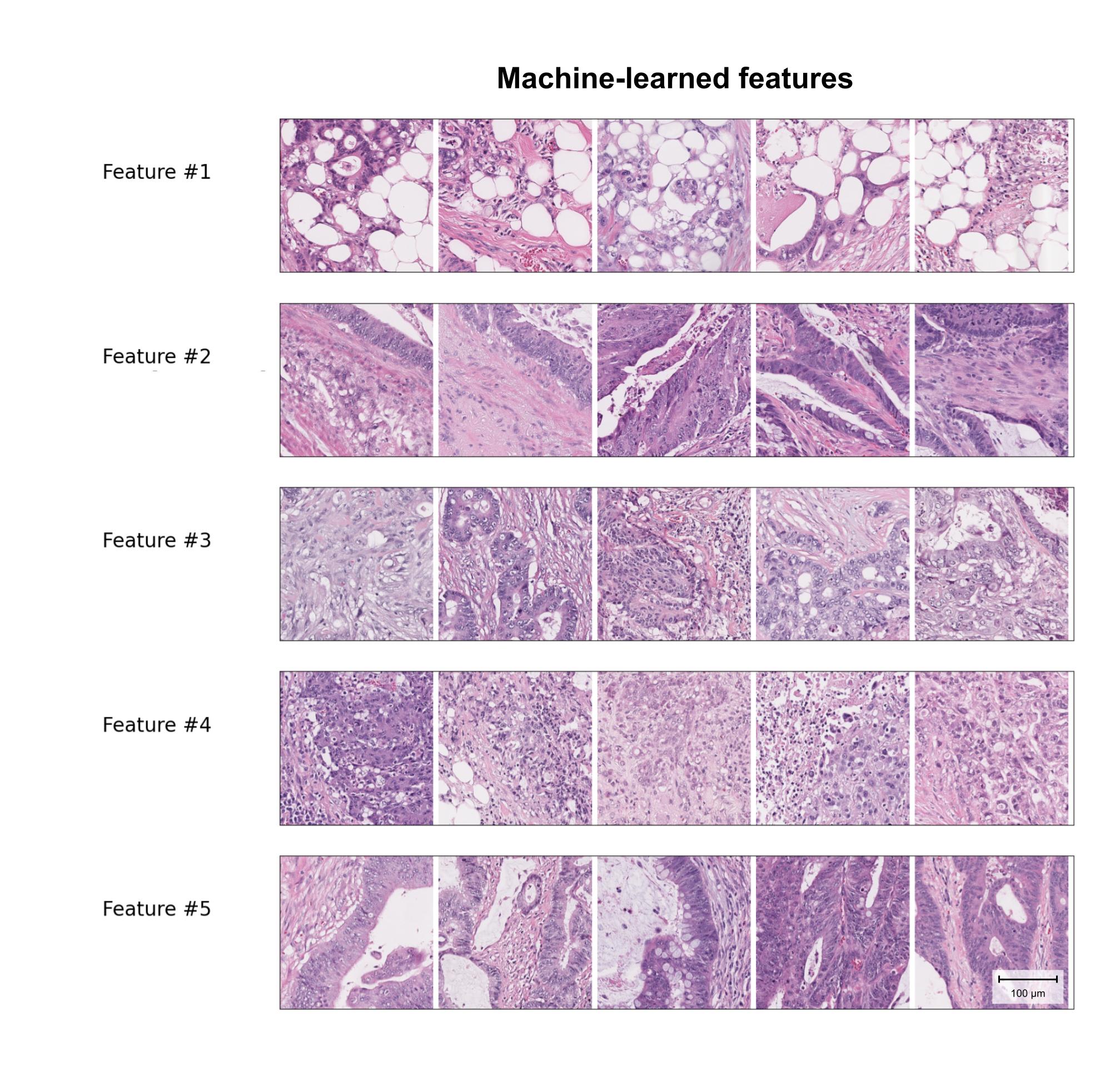 Sample patches from the top 5 selected machine-learned features Sample patches from the top 5 selected machine-learned features