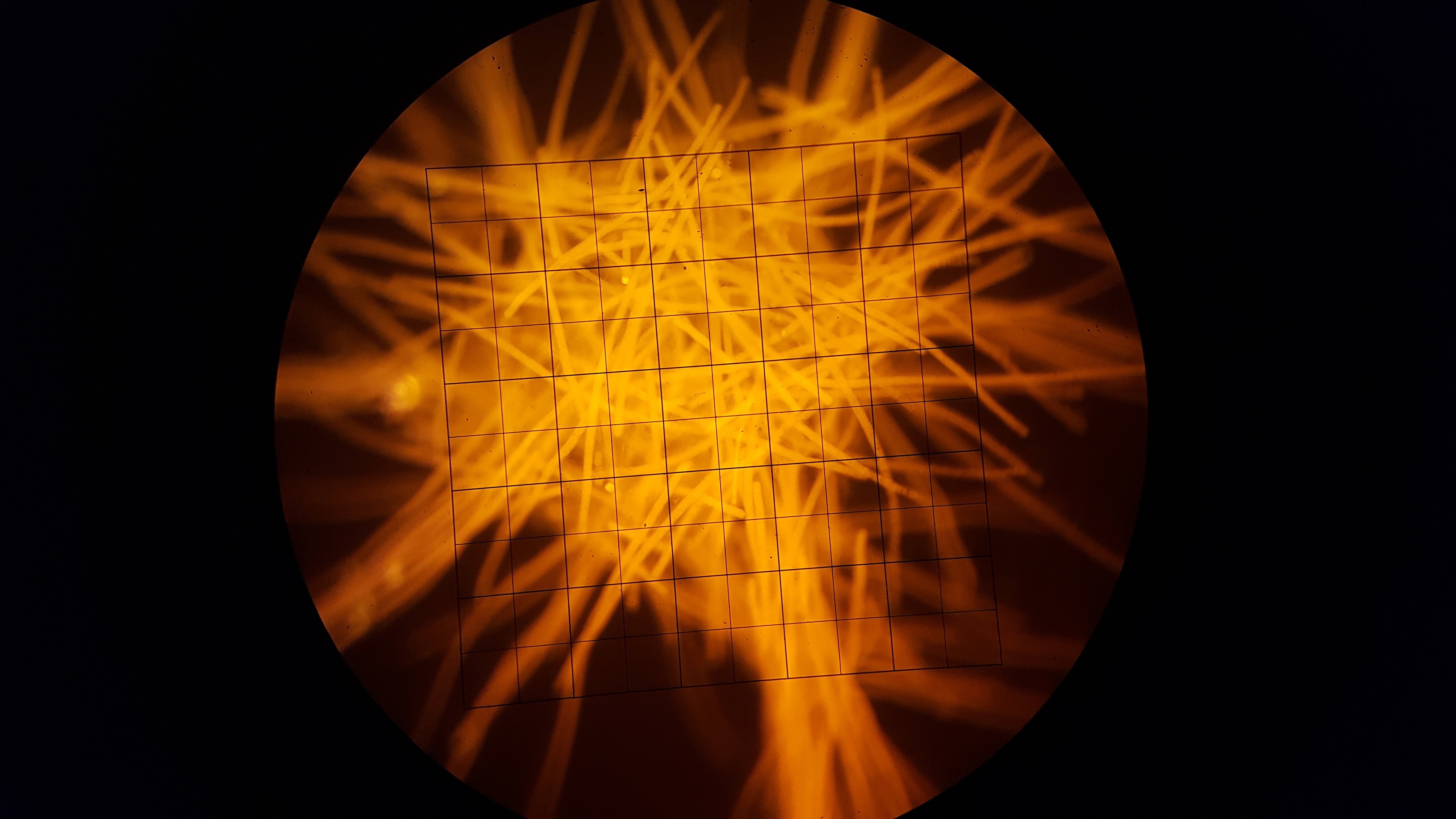Microscopy of a Trichodesmium colony with the filaments glowing orange due to the presence of light harvesting pigments.