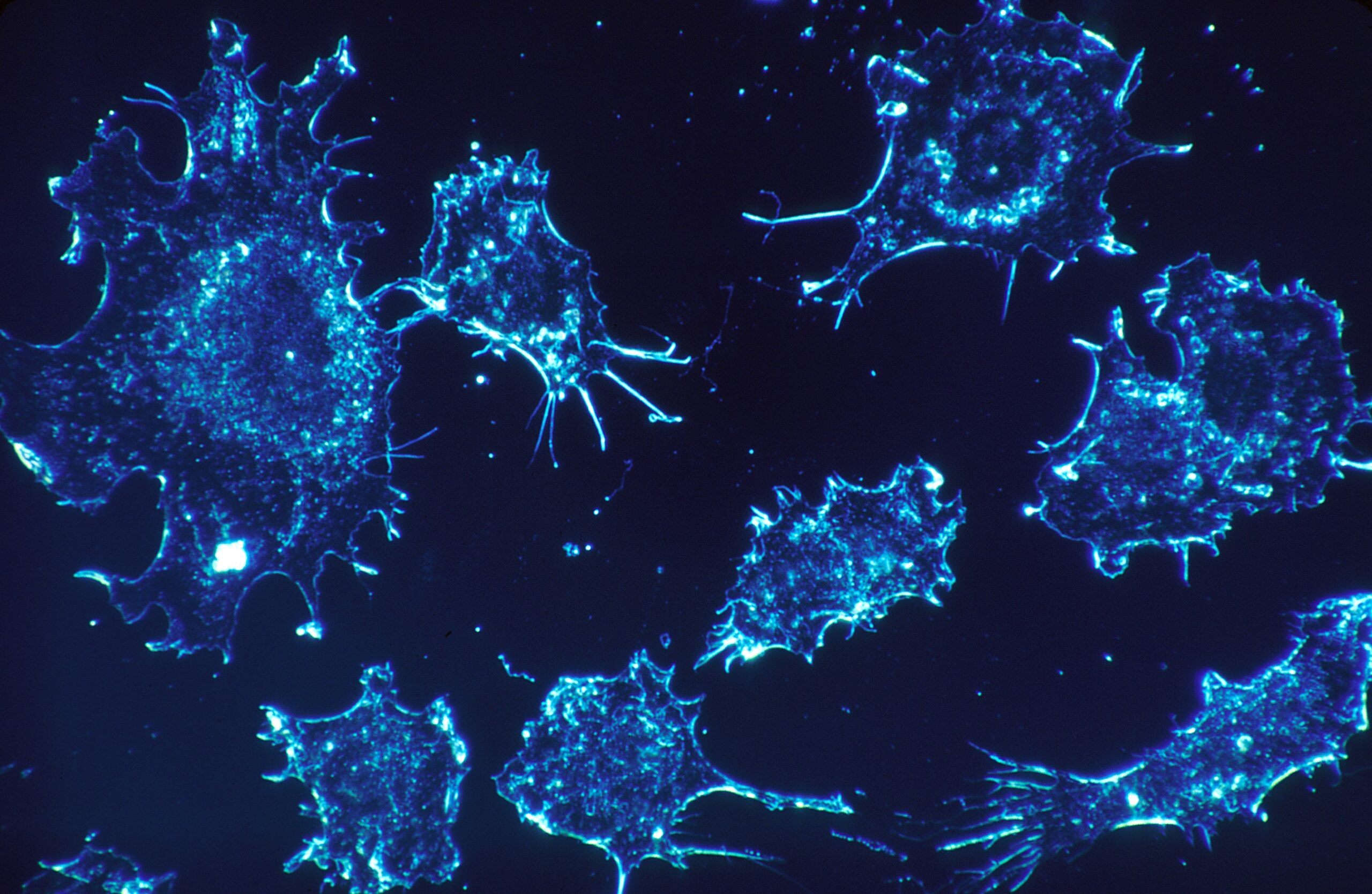 NCSA's Cancer Cells