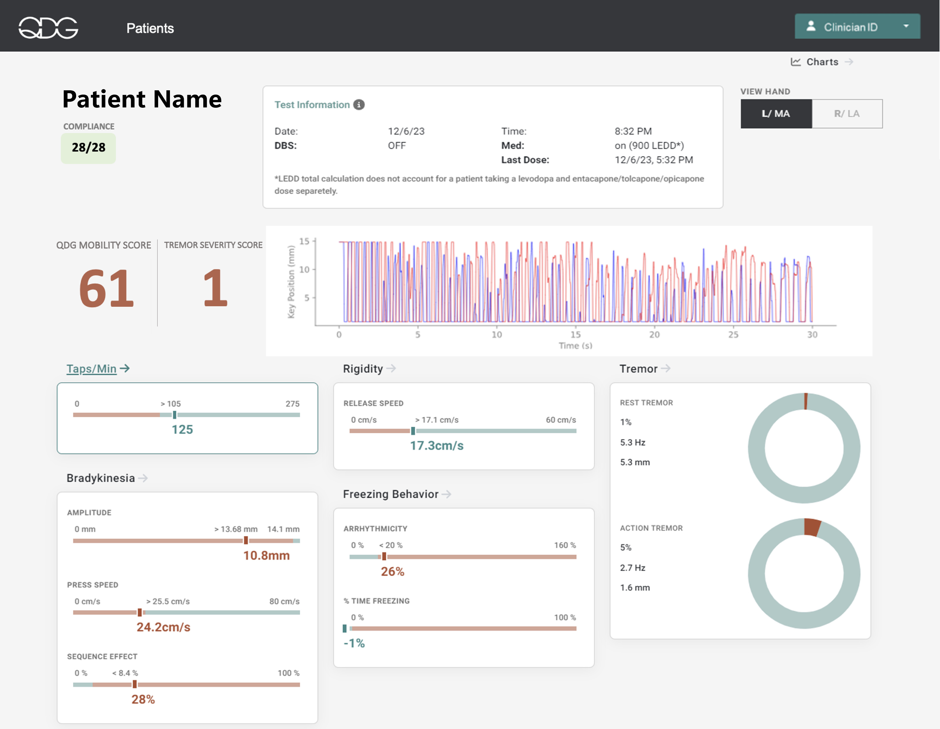 Depiction of the QDG web dashboard which visualizes the calculated metrics from a single RAFT test for all the cardinal motor signs of Parkinson’s Disease.