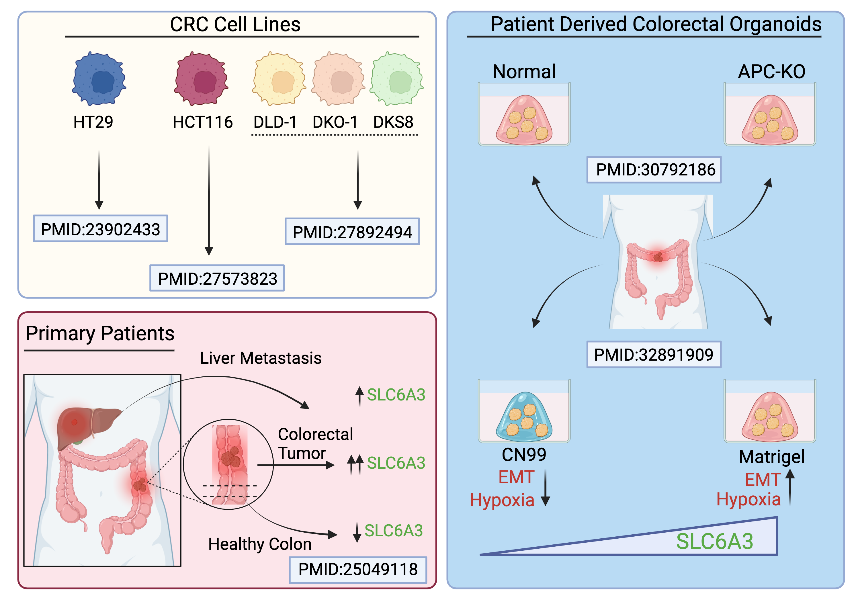 Figure 1: SLC6A3 expression in human colon cancer