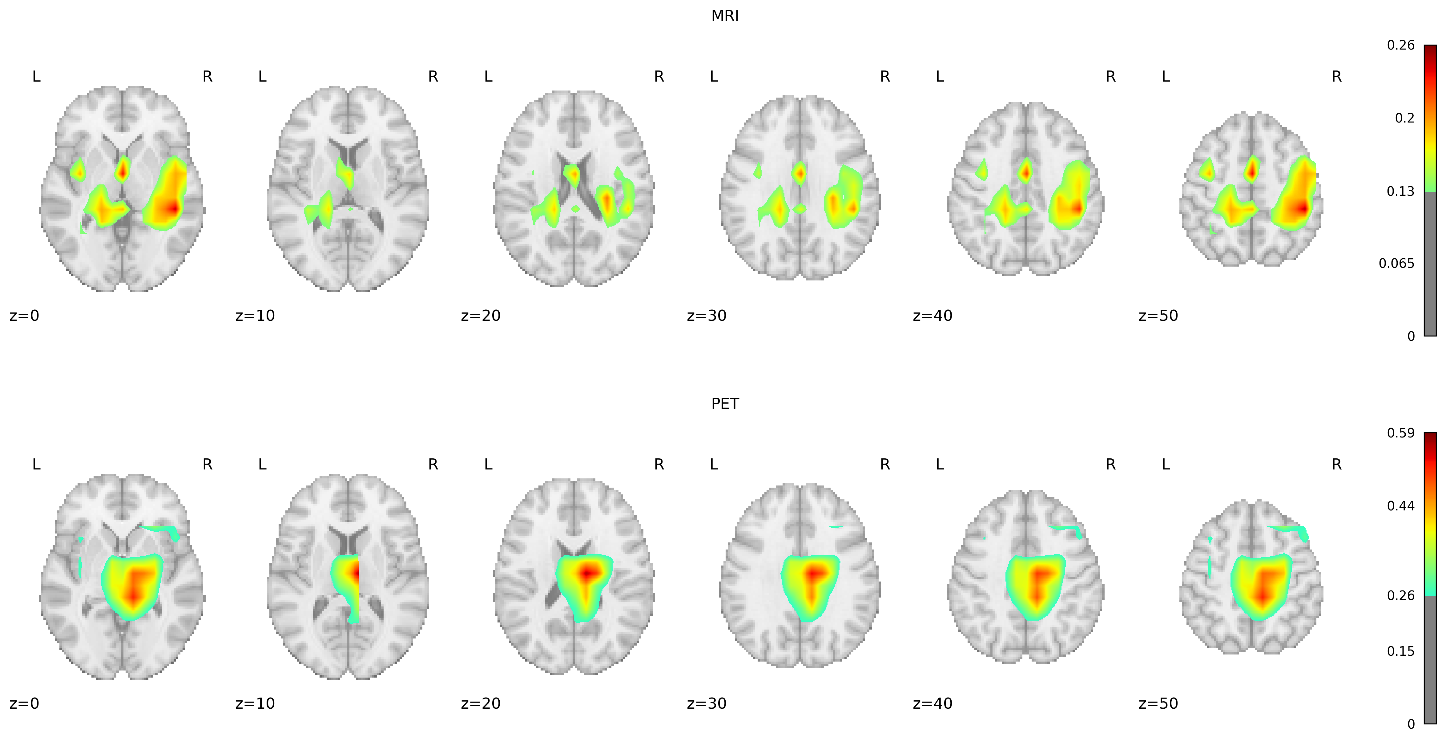 Heatmaps for both MRIs and PET scans