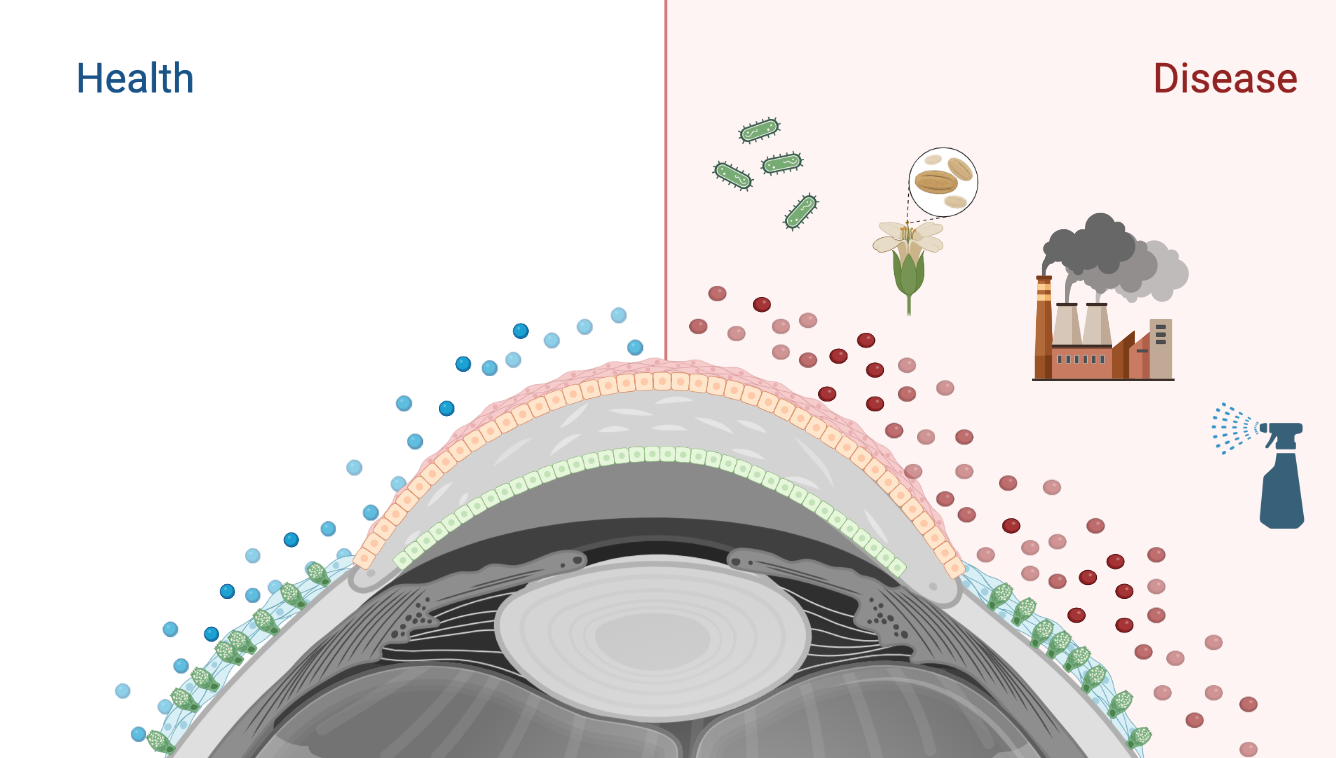 The normal structure of ocular surface and goblet cell secretion in health and disease The ocular surface is made up of the cornea (shown as the dome-shaped structure in the center), conjunctiva (shown as the blue membranous structure on each side), and the tear film that covers both structures. Conjunctival goblet cells are distributed throughout the conjunctiva (shown in green), polarized with the secretory granules closer to the outer surface of the conjunctiva. In health, the goblet cells maintain a basal mucin secretion level (shown as blue spheres) to moisturize and lubricate the ocular surface; when exposed to pathogens or allergens, the overactive goblet cells will secrete excessive mucin (shown as red spheres) that causes sticky and itchy eyes.