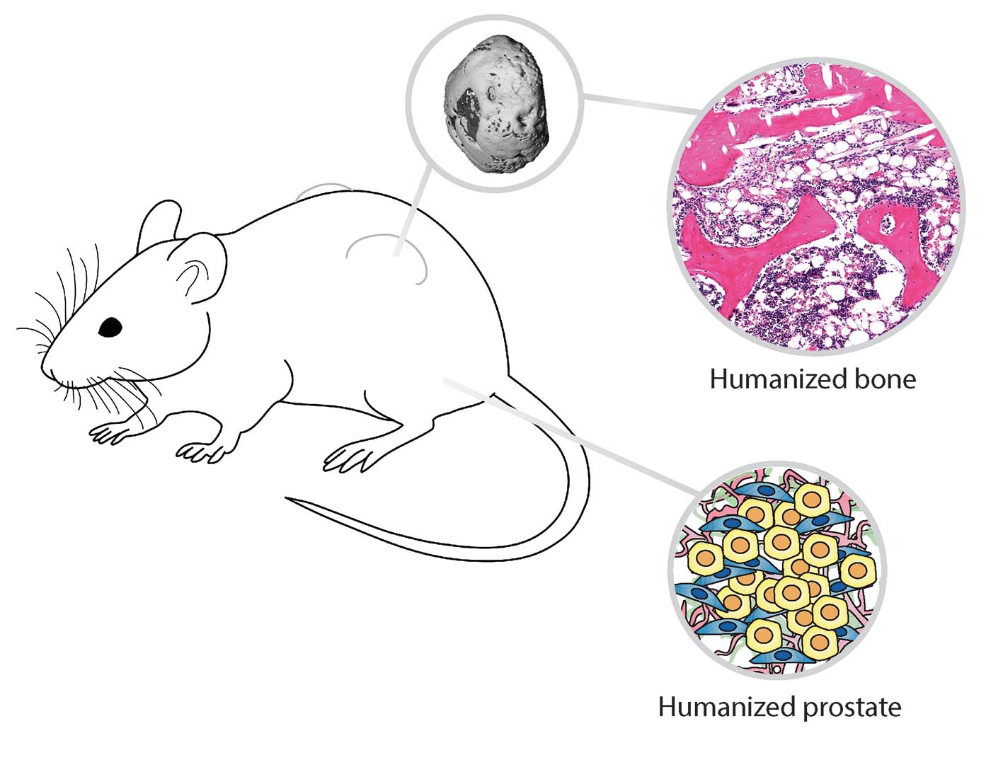 Experimental overview. Creation of a humanized tissue engineered bone construct (hTEBC) and a humanized prostate tumor microenvironment (TME)