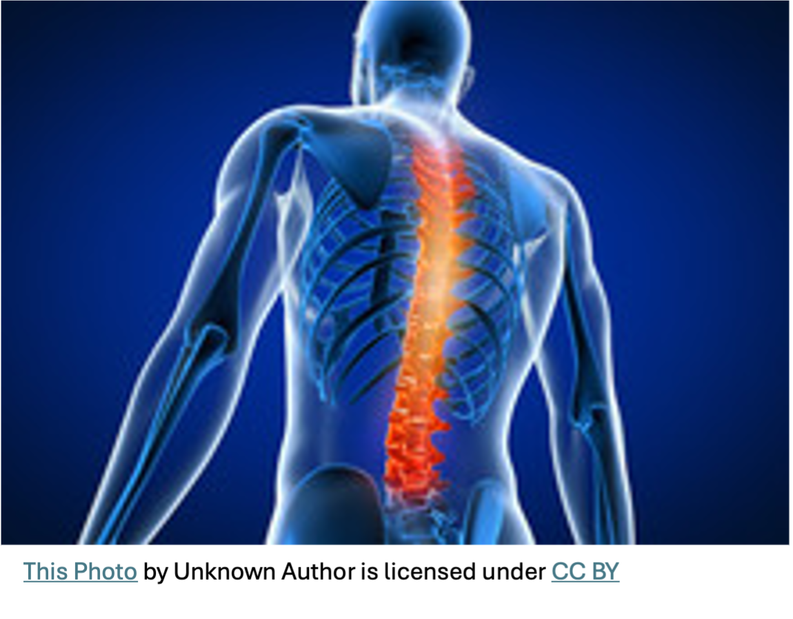 Musculoskeletal strain