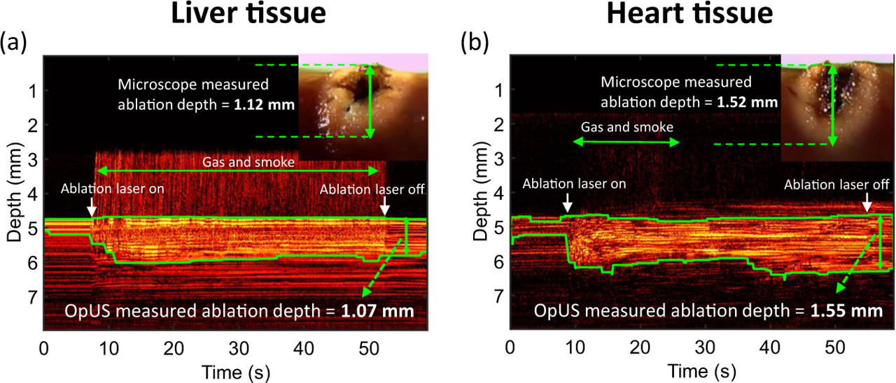 M-mode all-optical ultrasound images taken during contact laser ablation with corresponding microscope images inset.