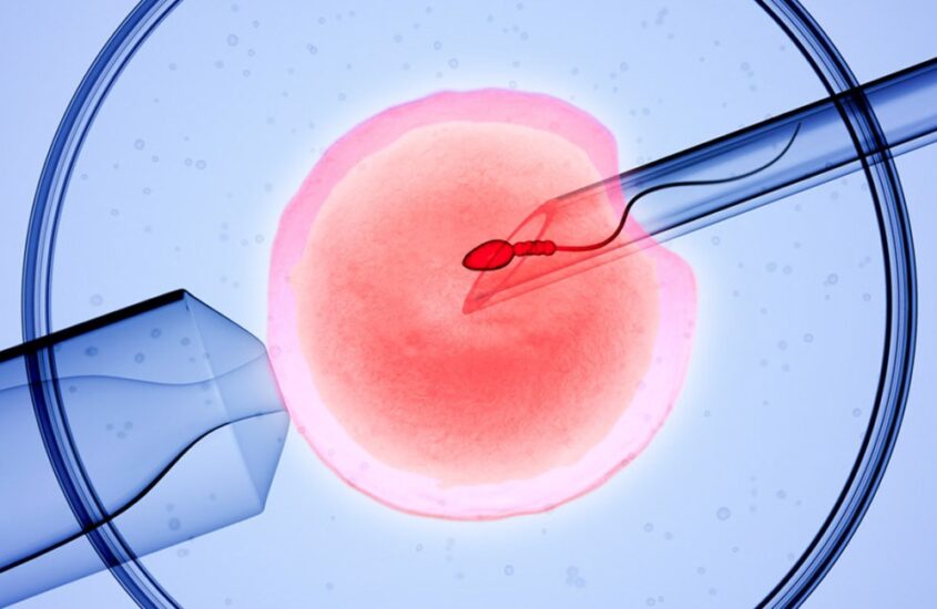 IVF procedure