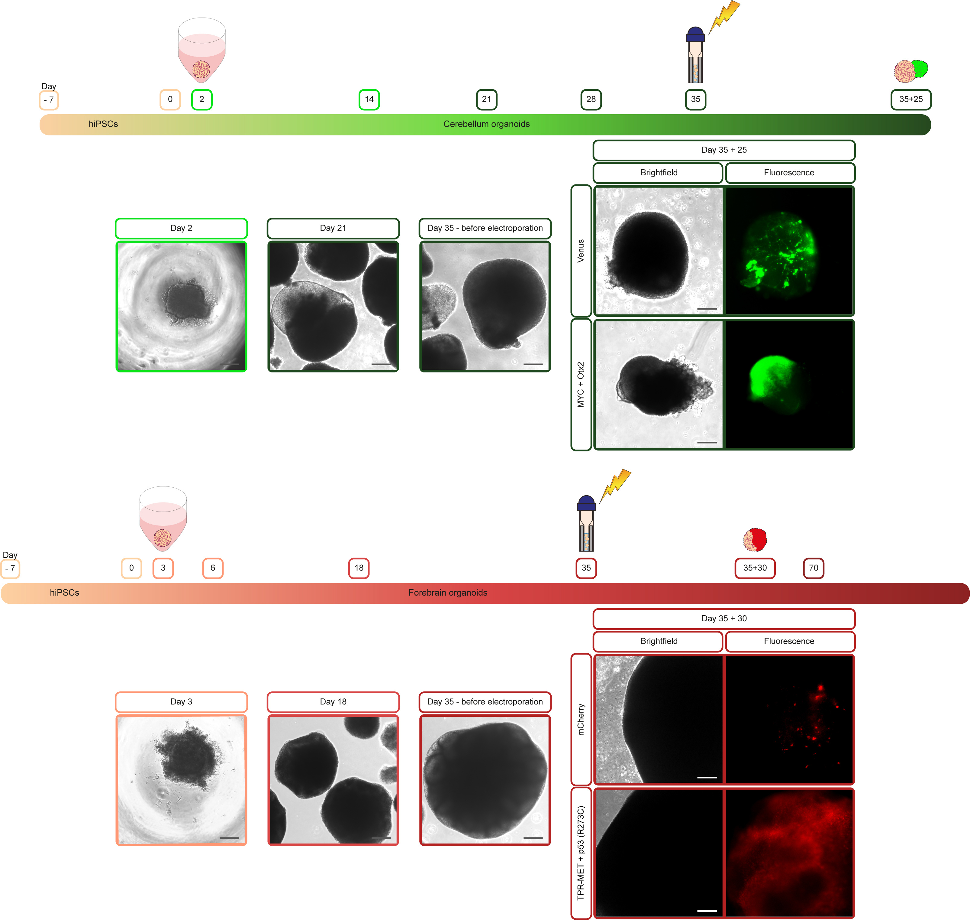 Workflow for generation of cerebellum and forebrain organoids and their electroporation to obtain MB and HGG cancer organoids.