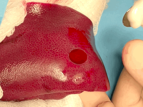 Pig liver hemostasis Pig liver hemostasis