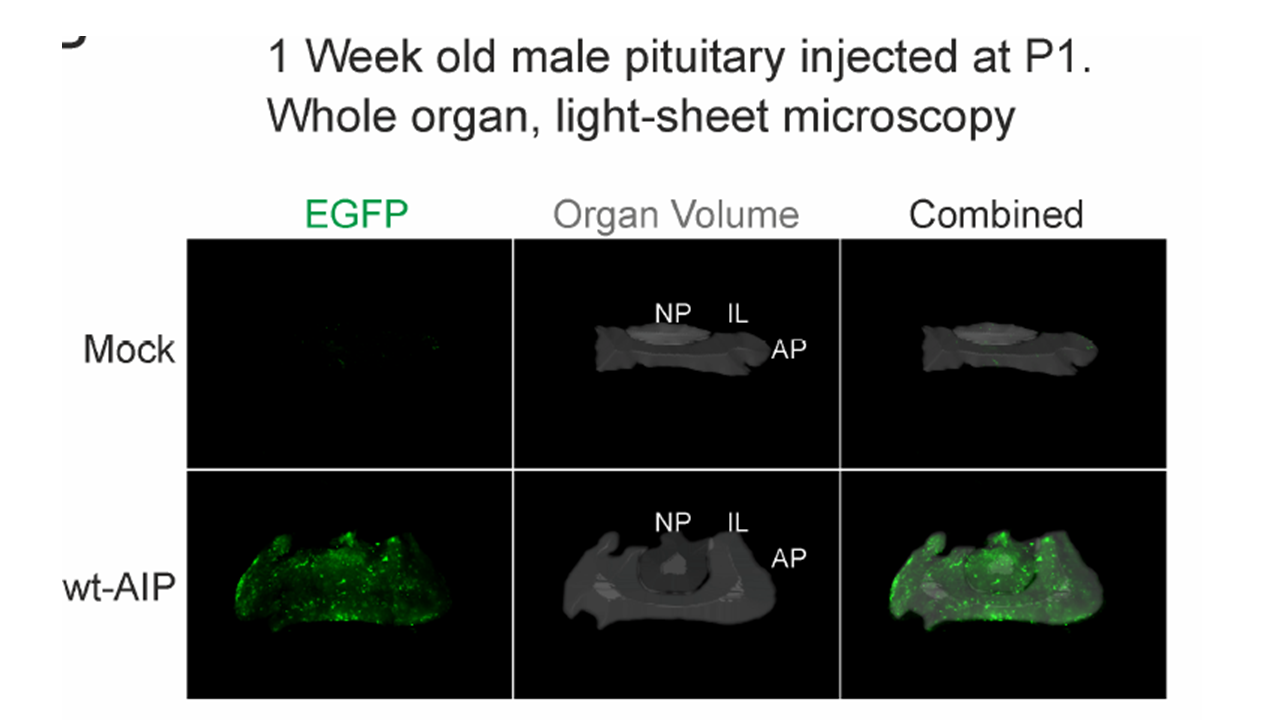Light-sheet microscopy of 1-week old male pituitary injected at P1 with retrovirus bearing wtAIP-IRES-EGFP