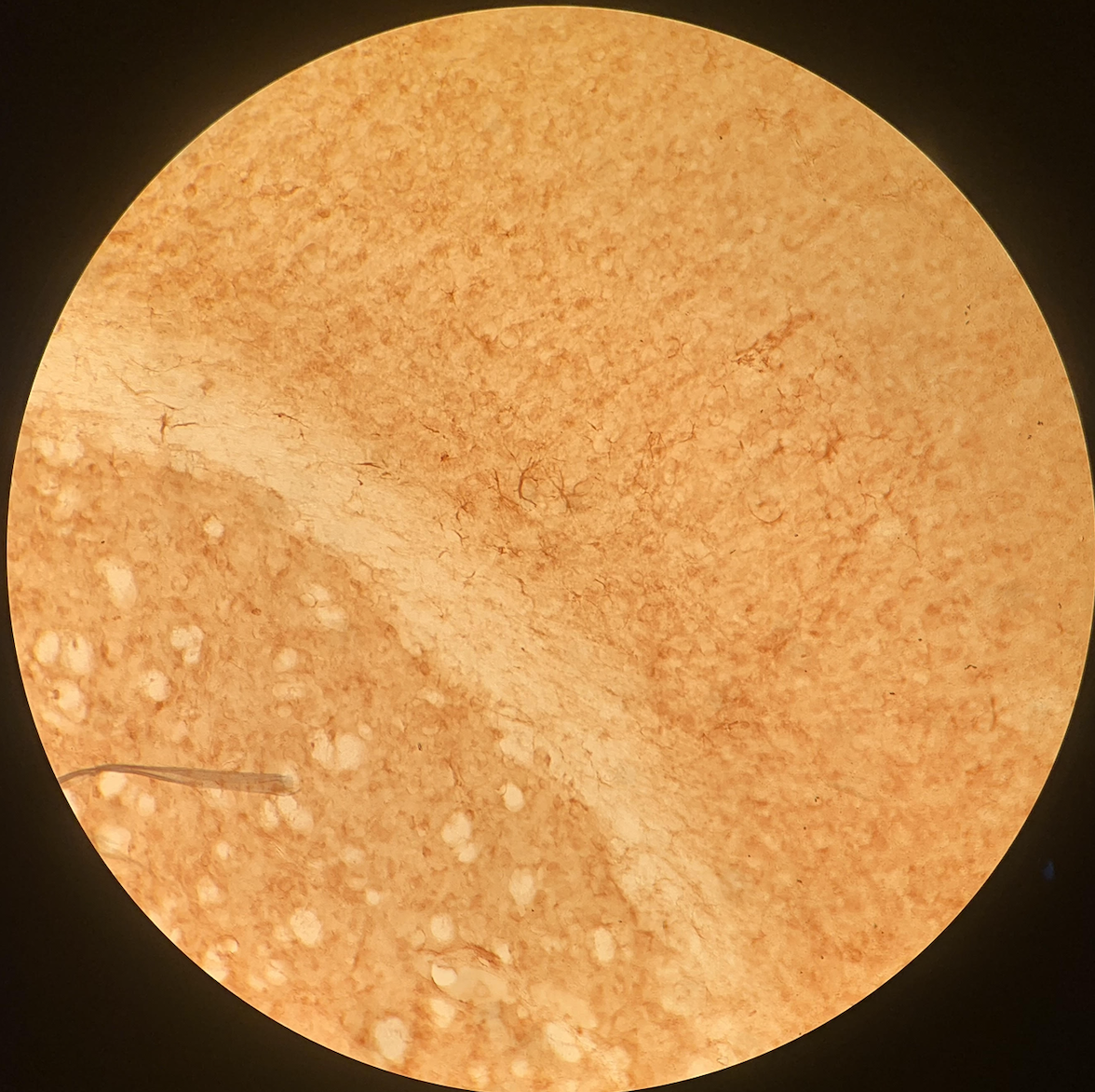 Senescent astrocytes stained using Beta-Galactosidase Immunohistochemistry