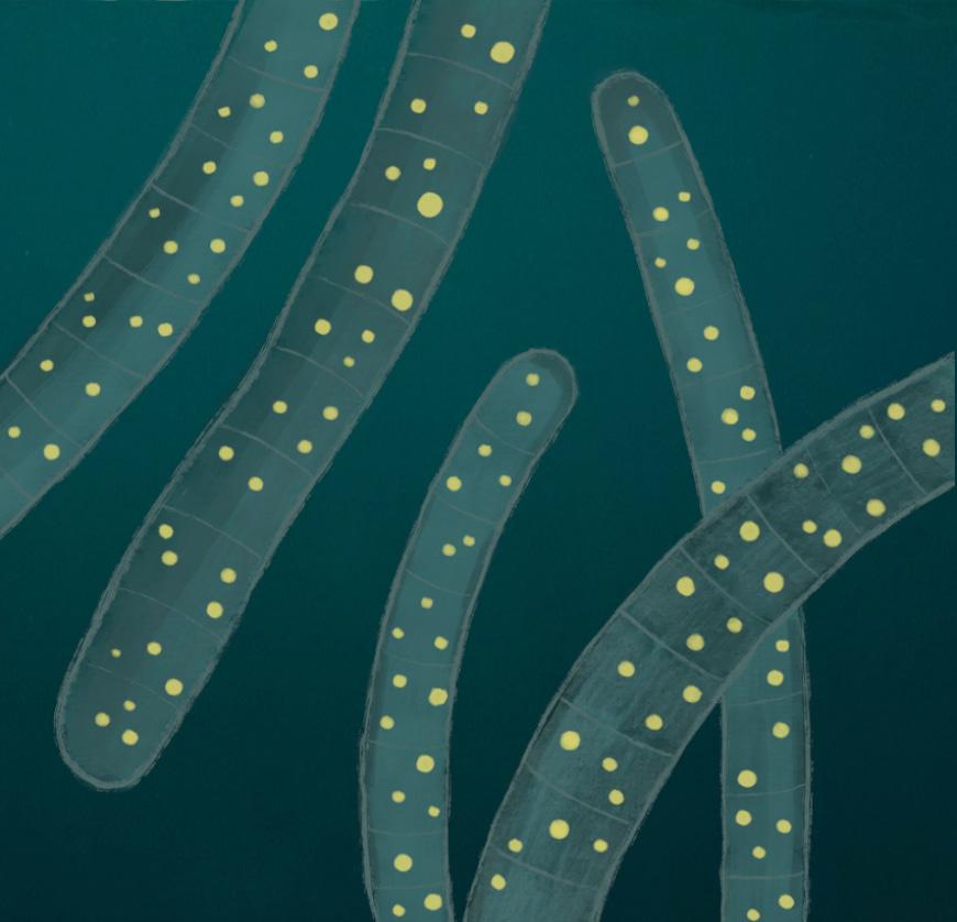 Beggiatoa with yellow sulfur inside