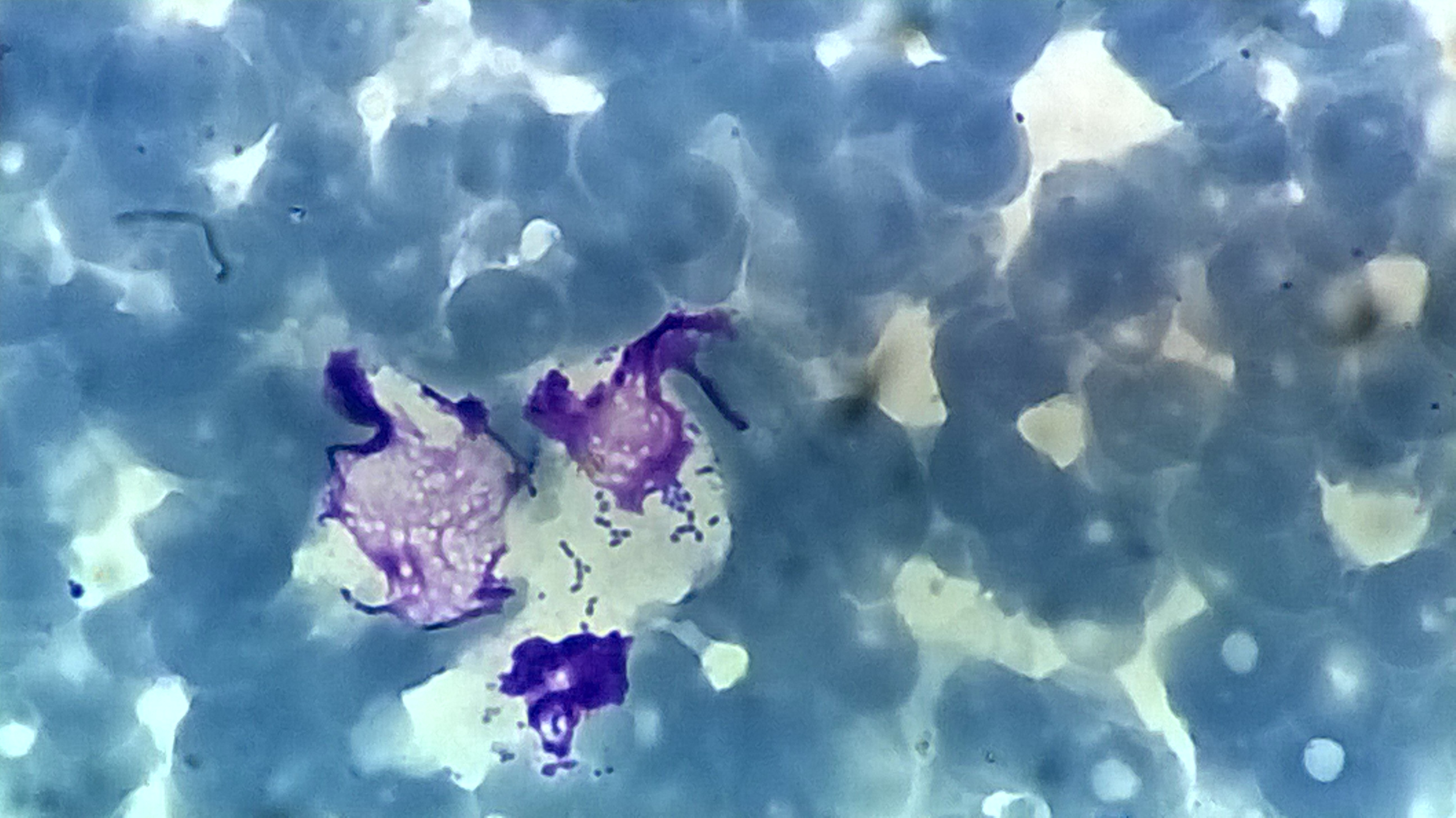 A blood smear showing bacteria