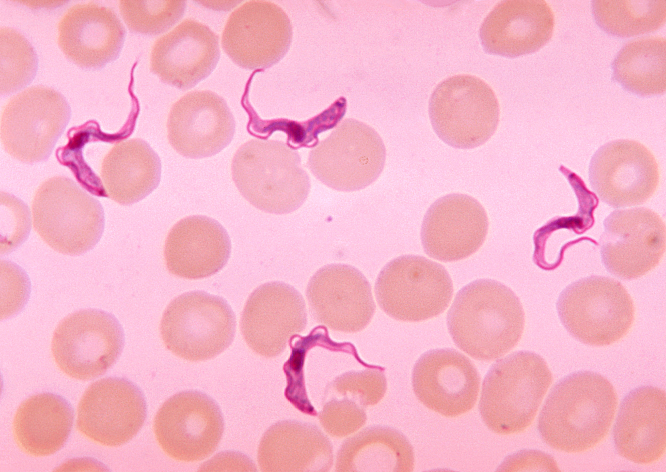 Parasite causing African trypanosomiasis Parasite causing African trypanosomiasis