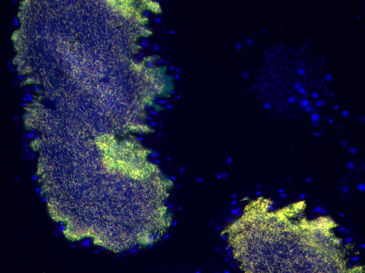 Burkholderia gladioli bacteria inside the glands of Lagria villosa beetles. You see the symbionts in yellow and the insect cell nuclei in blue.