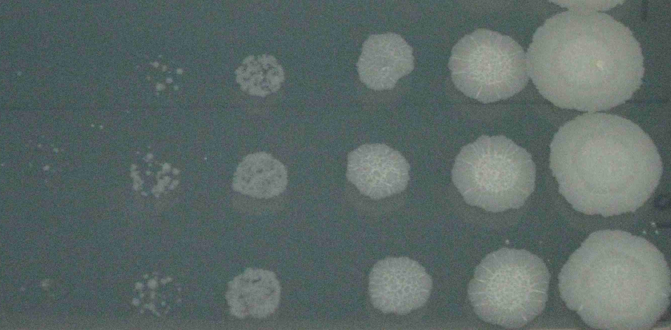 TB Spot Dilutions by S. Wakabayashi