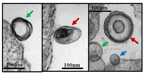 Transmission Electron Microscopy images of vesicles surrounding LRV1 particles Transmission Electron Microscopy images of vesicles surrounding LRV1 particles