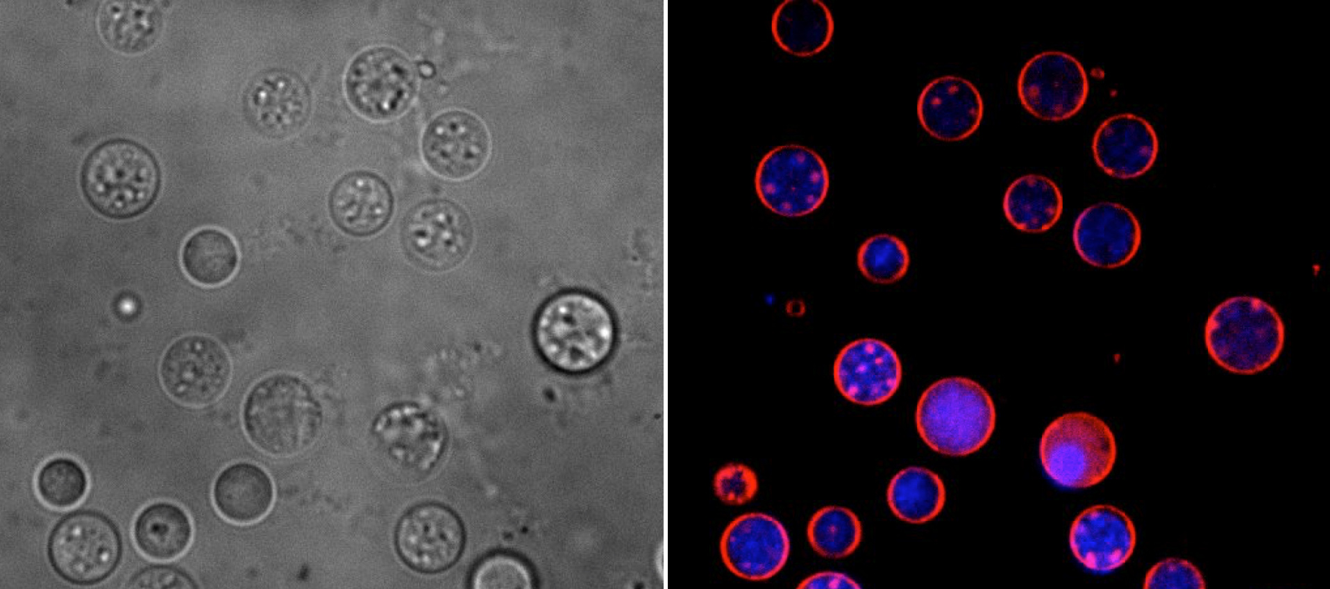 S-cells of Kitasatospora viridifaciens S-cells of Kitasatospora viridifaciens