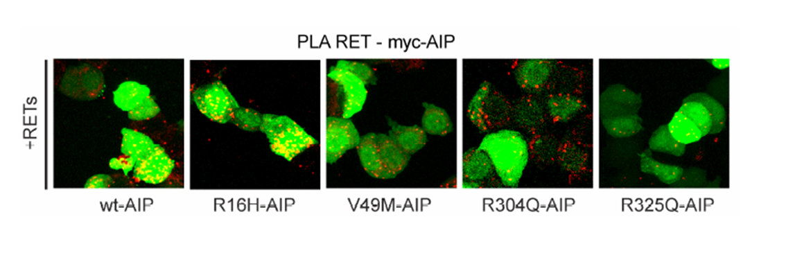 PLA-assay of RET + AIP: wt compared to mutants