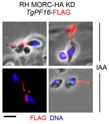MORC and HDAC3 maintain a great number of sexual-stage genes in a sustained repressive chromatin state MORC and HDAC3 maintain a great number of sexual-stage genes in a sustained repressive chromatin state