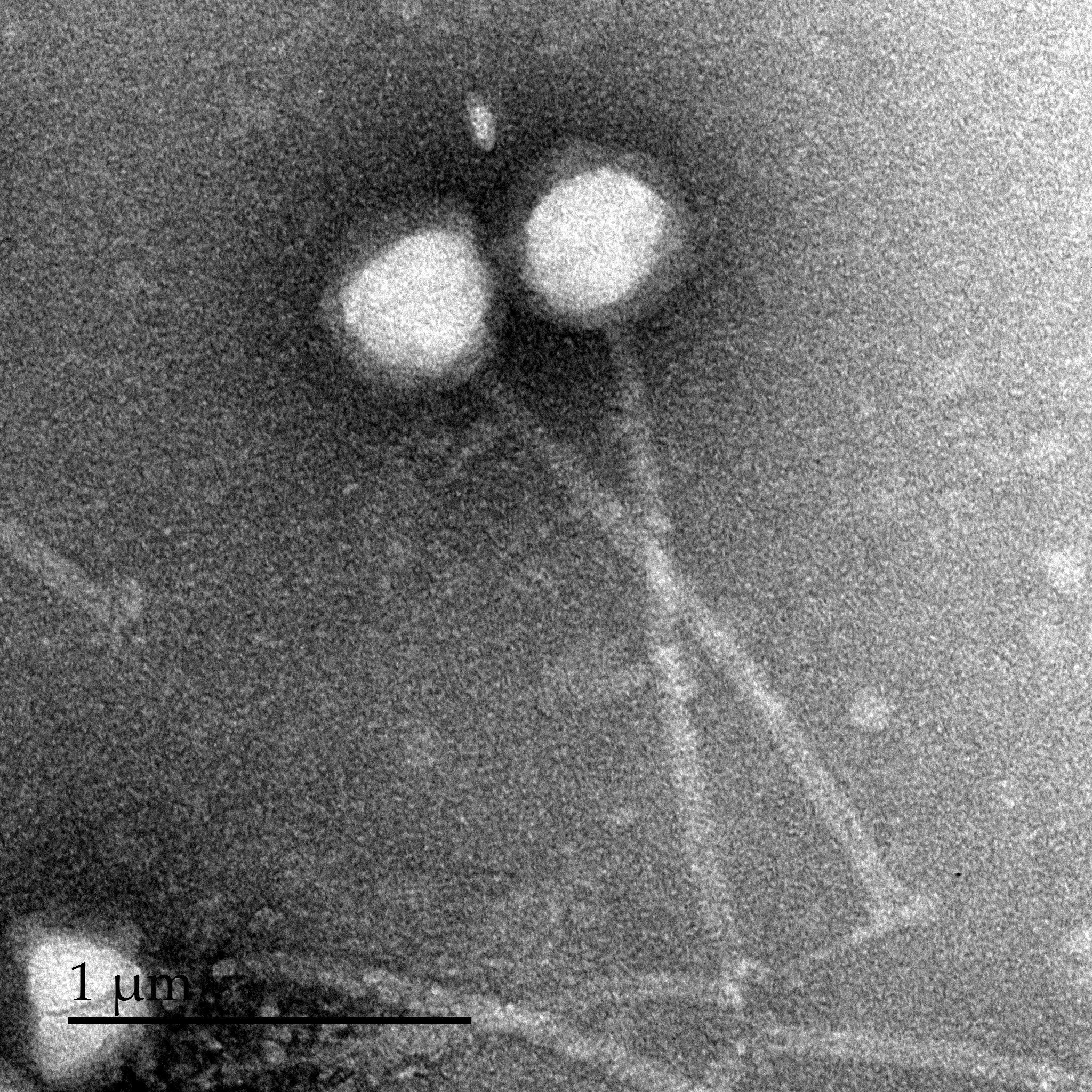 Glum Electron Microscopy Glum Electron Microscopy