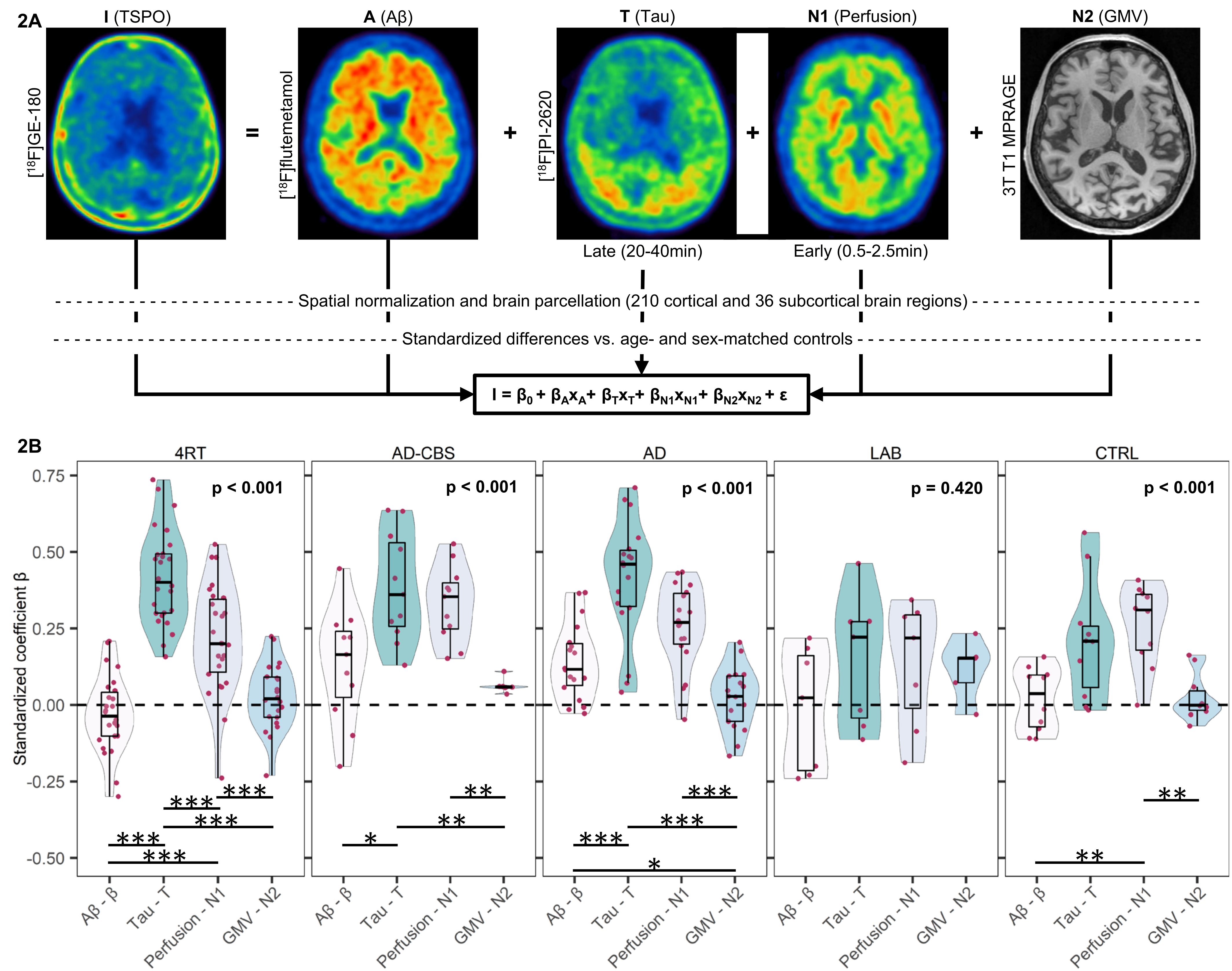 Multiregional regression analysis to determine the association of ATN biomarkers with microglial activation at the individual patient level. A Methodological workflow: PET and MRI data were spatial normalized to tracer specific templates acquired in previous in house studies (Montreal Neurology Institute (MNI) space) and parcellated into 210 cortical and 36 subcortical brain regions. PET-tracer uptake and gray-matter-volumes (GMV, from MRI) were transformed into z-scores with age- and sex-matched controls. A multiple linear regression model was performed (I = β0+ βAxA + βTxT + βN1xN1 + βN2xN2 + ε) at the single-patient-level and standardized coefficients (β) were derived for each ATN biomarker. B β-coefficients were visualized as a combined violin-box-plot and show the association of ATN biomarkers with microglia activation, each dot representing a single subject. Within each diagnosis group, the β-coefficients of the four independent variables were tested for group differences using ANOVA with age and sex as covariates. Multiple posthoc tests (dichotomous ANOVA, age, and sex corrected) were performed if there was a significant group difference. Combined false discovery rate (FDR, six p-values) and Bonferroni (five p-values) correction were applied to decrease the risk of α-error-accumulation. *p < 0.05, **p < 0.01, ***p < 0.001. AD Alzheimer’s disease, AD-CBS corticobasal syndrome with AD-pathology, 4RT four-repeat tauopathies, LAB low affinity binder, CTRL healthy controls, TSPO 18-kDa translocator protein, Aβ β-amyloid, GMV gray-matter-volume, PET positron-emissions-tomography, MRI magnetic-resonance-imaging, MNI Montreal Neurology Institute, ANOVA analysis of variance, FDR false discovery rate.