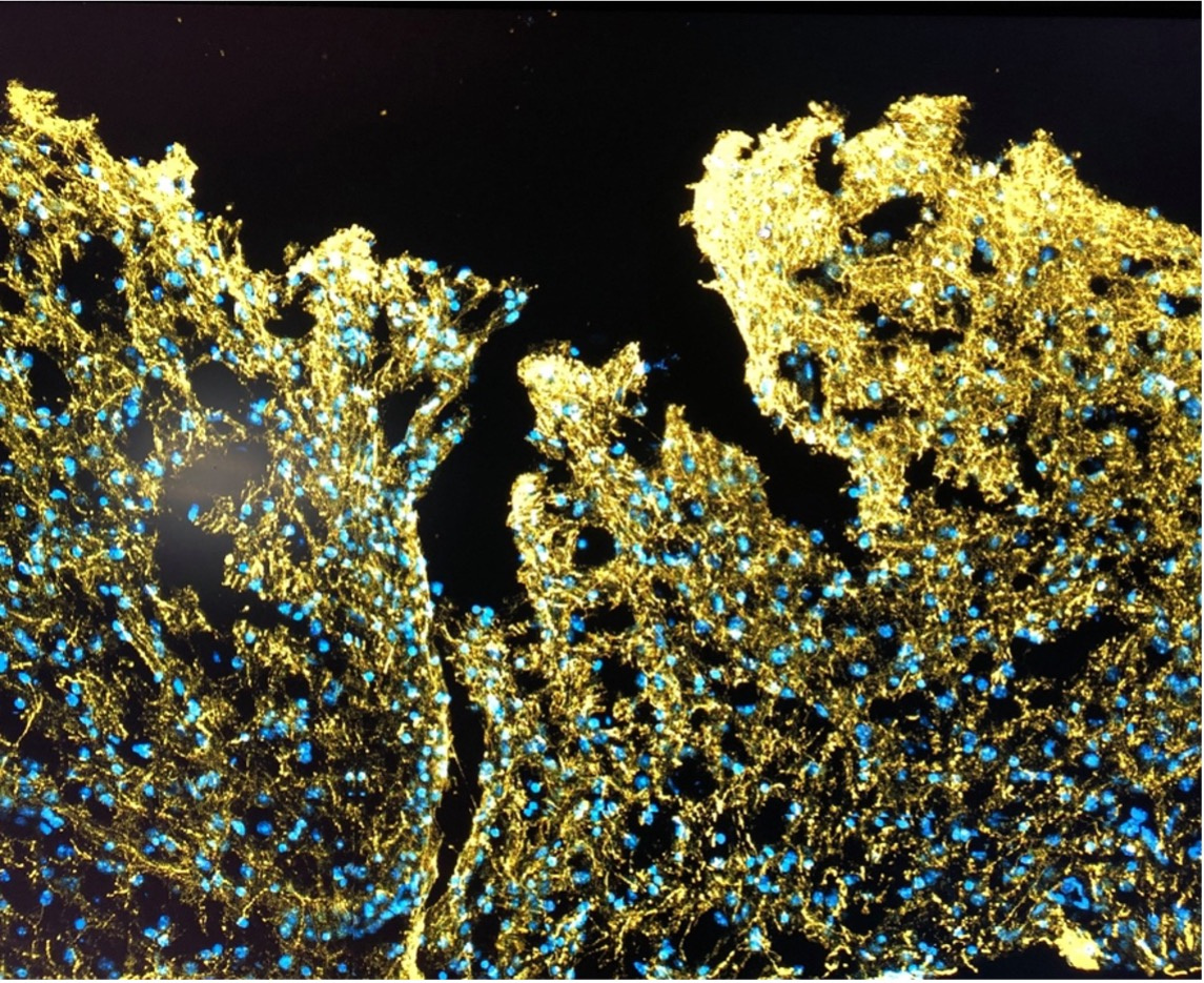 Wireless electrical stimulation of injectable hydrogel-implanted animals following severe TBI. The nucleic (blue) and neuron (yellow) in the trauma cavity after 82 days post-surgery. Photo credit: Dr. Ru-Siou Hsu, NTHU.