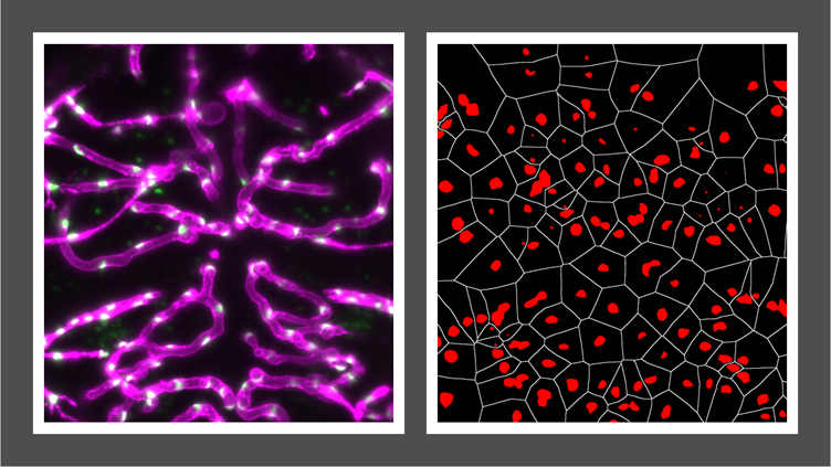 Images of blood vessels and their individual cell nuclei in the brain of a developing zebrafish.