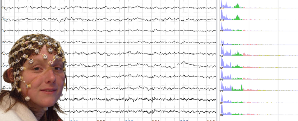 A young woman weaing a EEG cap and brain neural activity as recorded by EEG across various scalp electrodes