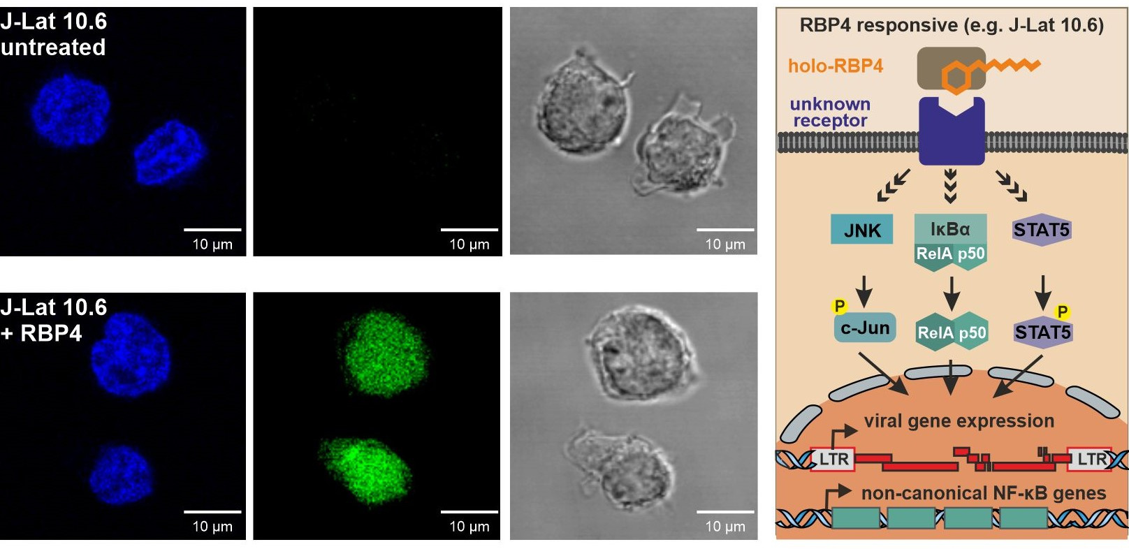 A vitamini taşıyıcısı RBP4, gizli HIV-1'i yeniden etkinleştirir