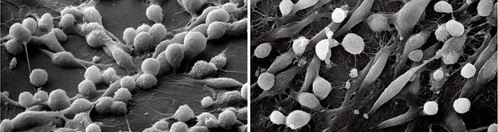 Black-and-white scanning electron microscopy image of colorectal cancer cells grown in artificial extracellular matrix. Left: Matrigel-only, cells are more round. Right: Matrigel with collagen fibrils, cells acquire a spindle-like morphology.