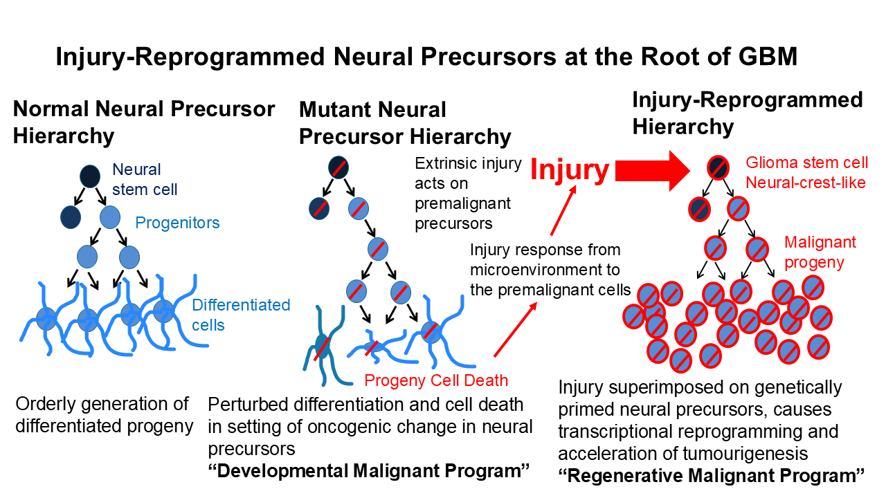 Injury-Reprogrammed Neural Precursors at the Root of GBM