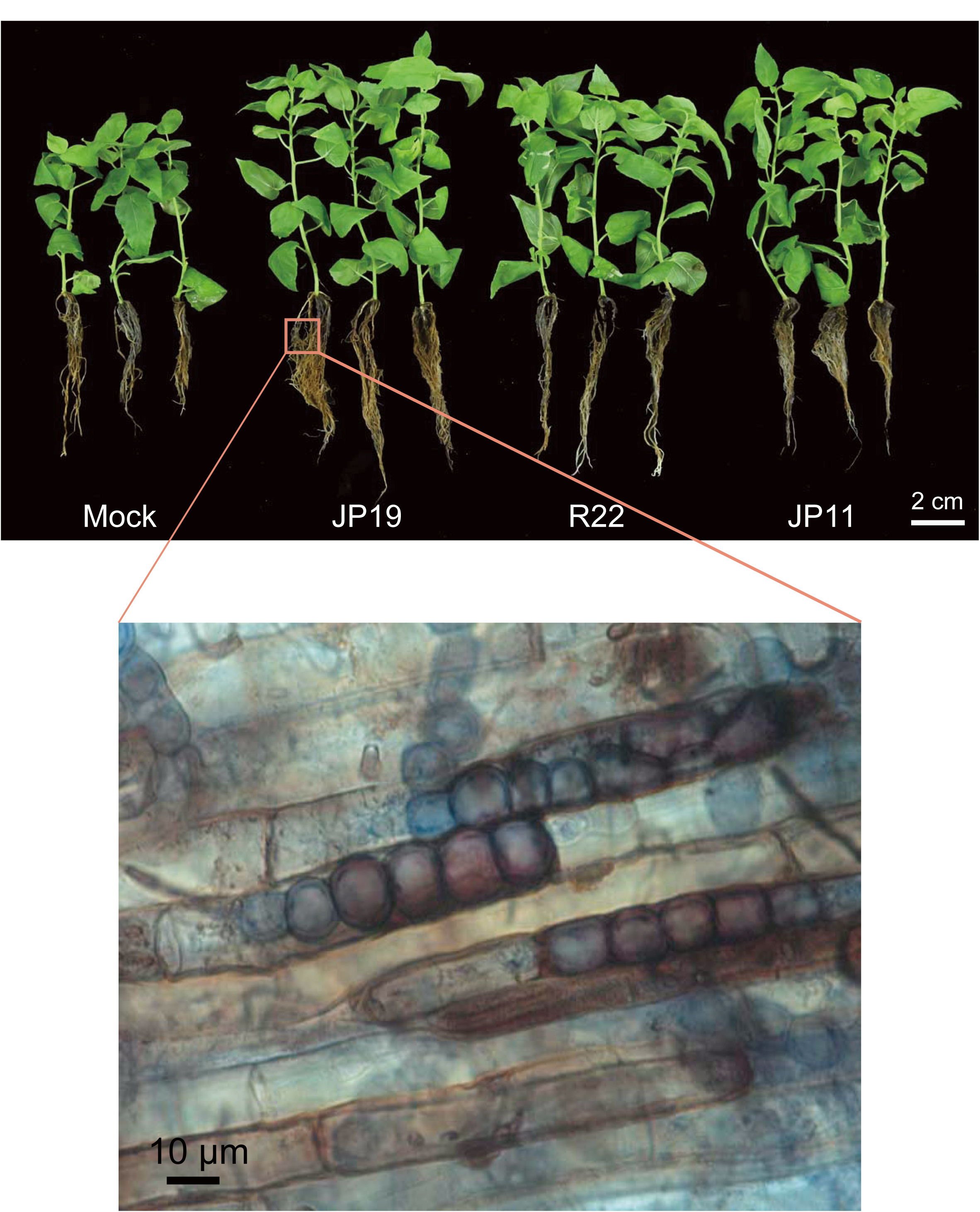 The DSE fungus Laburnicola rhizohalophila successfully infects host roots and forms microsclerotia-like structures in the cortical cells. Under 0.2 M NaCl stress conditions, the diploid isolate JP19 confers more fitness to poplar growth and root development compared to its parents (R22 and JP11) and the control group.