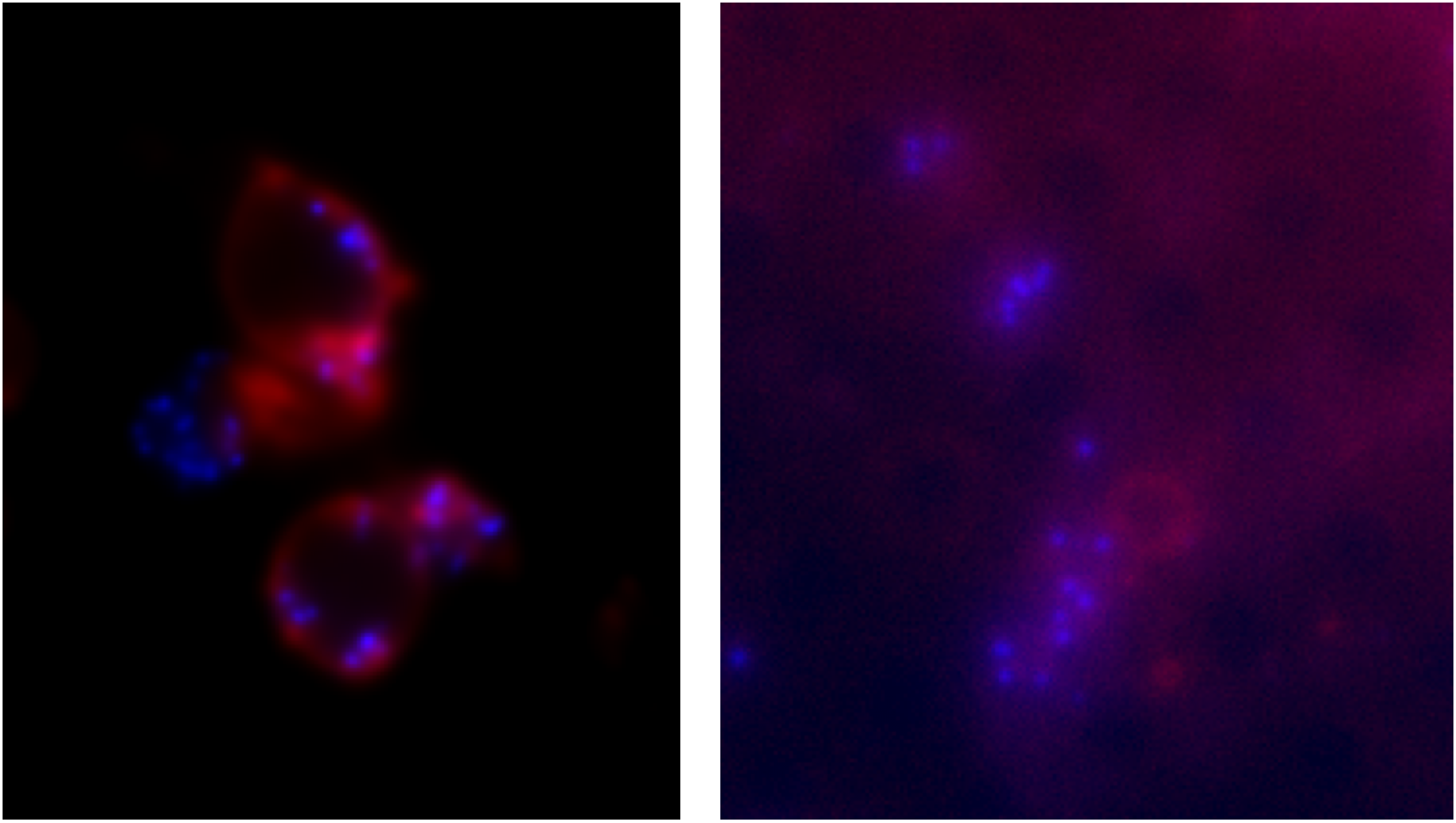 With Anna Sartori-Rupp, we had some heated debates whether the ruptured vesicles with discontinuous membranes we saw sometimes in CryoEM were a biological reality or an artefact of blotting. This little experiment settled the debate once and for all. You’re looking at an epifluorescence image (red – FM 4-64 coloration of biological membranes, blue – DAPI coloration of DNA) of Veillonella parvula ΔompM1-3 mutant deposited on a R 2/2 grid, on the left before the blotting, and on the right after it. As you can see, after the blotting the big vesicles are gone (exploded like soap bubbles hitting the ground) and fragments of the outer membrane have adhered to the mesh grid (visible as the diffuse red fluorescence with the black spots in the place of mesh grid holes)