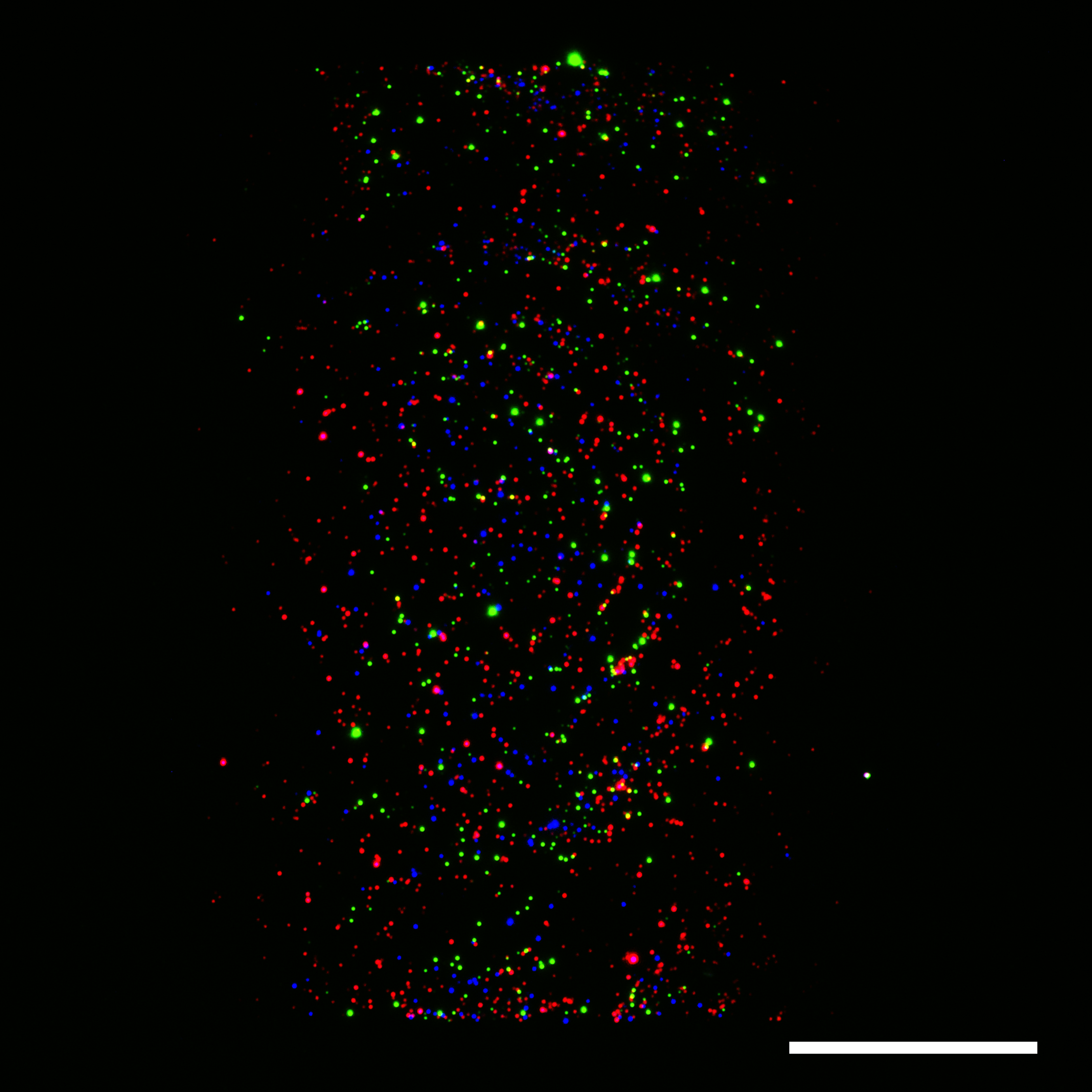 An image of EVs stained with various markers