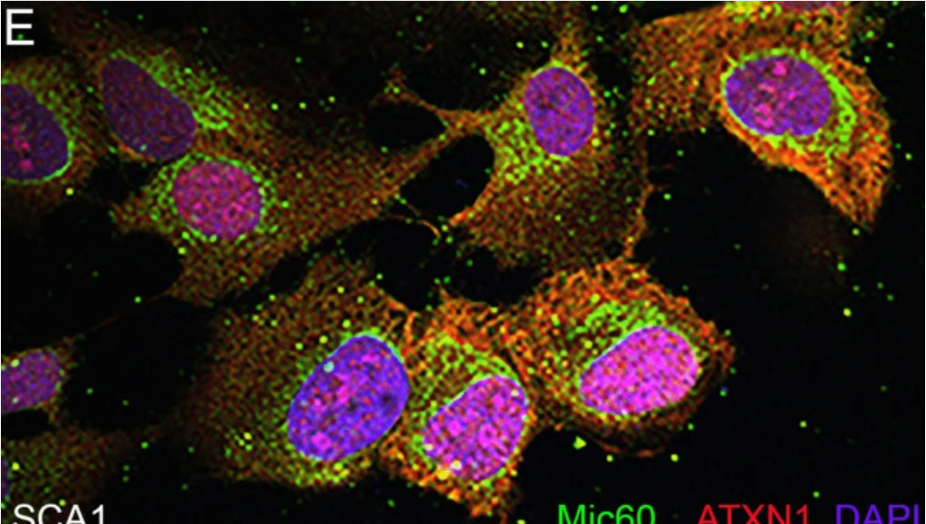 Ataksin-1'in sitoplazmik ve mitokondriyal etkileşimleri spinoserebellar ataksi tip 1'e (SCA1) katkıda bulunabilir