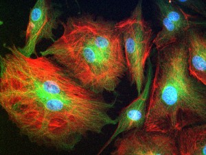 Cells showing flourescent markers