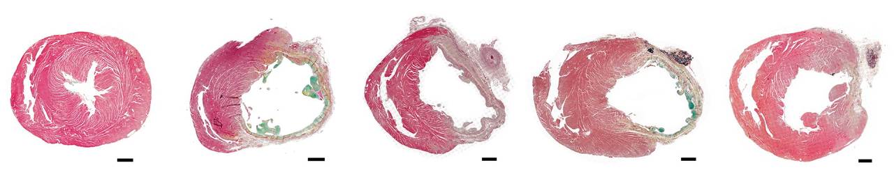 Cell-free therapy for the recovery of the injured heart