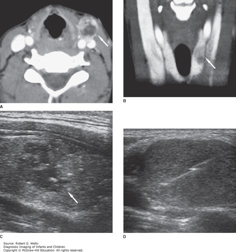 Ear, Nose and Throat Disorders Case