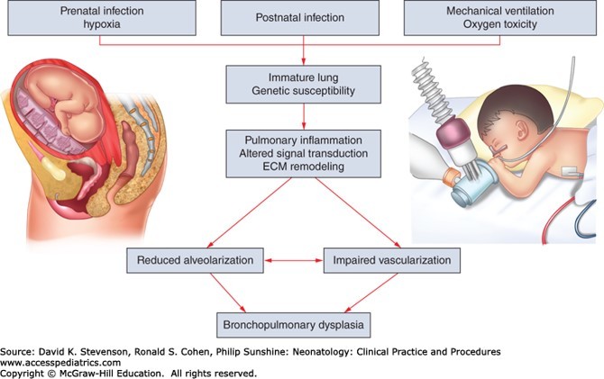 Fetus and Newborn Case