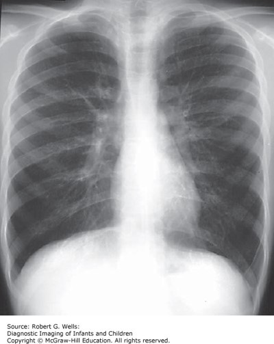 Pharmacology: Pain Management and Sedation Case