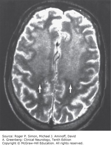 Dementia & Amnestic Disorders Diagnosis