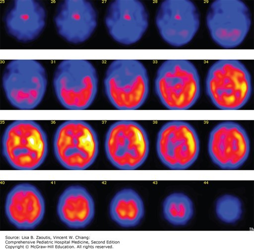 Fluid and Electrolyte Metabolism Case
