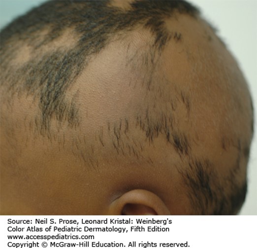 Disorders of Nails and Hair Diagnosis