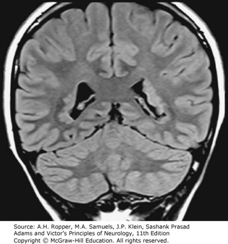 Developmental Diseases of the Nervous System Diagnosis 