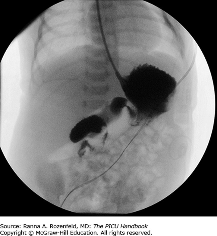 Pediatric Gastroenterology Case