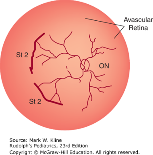 Eye Disorders Case